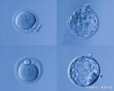 试管婴儿移植后第十天能测出怀孕吗_试管婴儿移植后最早几天能测出怀孕吗