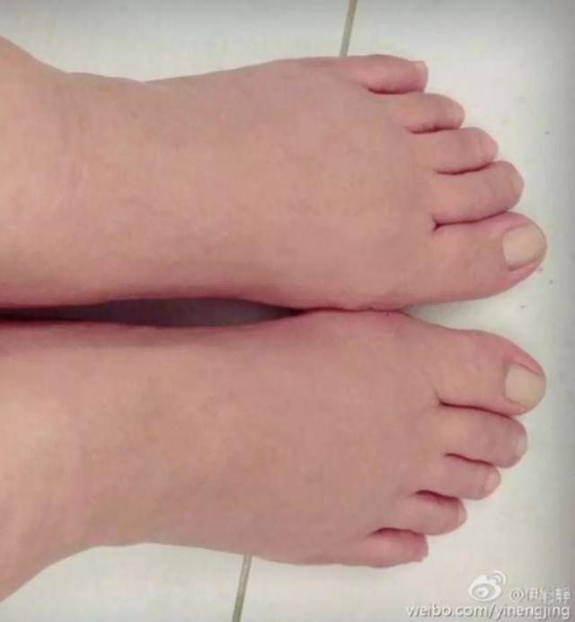 试管婴儿8周胎心停止什么原因_试管婴儿胎心停止发育是什么原因造成的