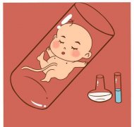 试管婴儿第一次去准备什么？