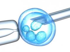 年轻男性精子活性不够打算做试管婴儿